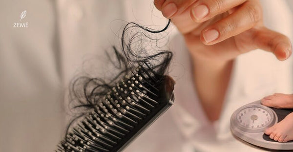 Does Losing Weight Cause Hair Loss?